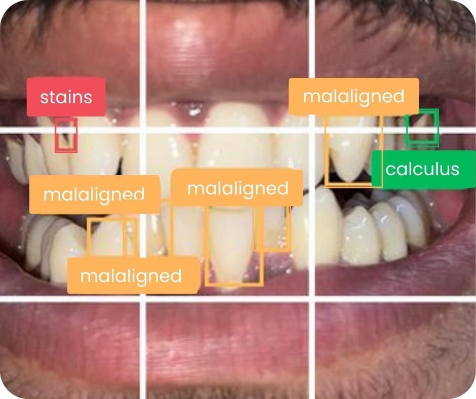 Prime Dental Clinic - RObotic Dental Checkup Sample Image